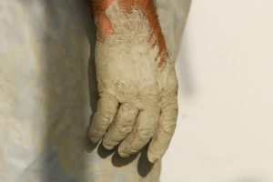 dry hands from pottery clay