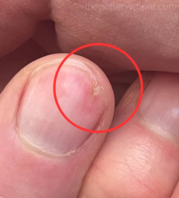 Damaged nail from making pottery